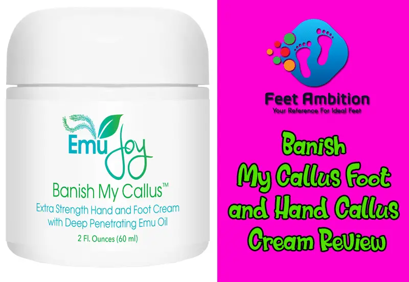 Banish My Callus Foot and Hand Callus Cream Review Banish My Callus Foot and Hand Callus Cream Review